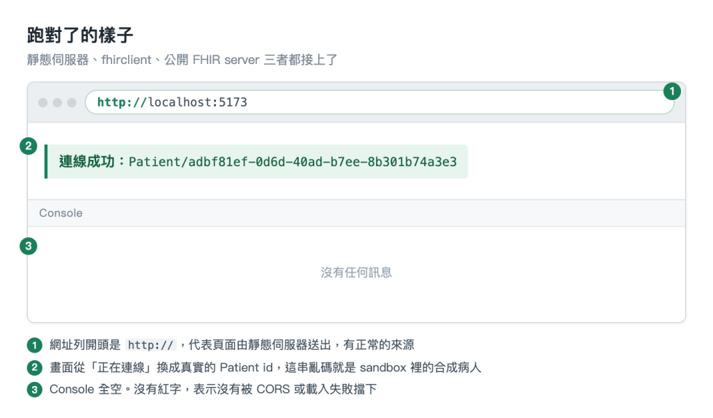 瀏覽器視窗，網址列顯示 http://localhost:5173，頁面內容為「連線成功：Patient/adbf81ef-0d6d-40ad-b7ee-8b301b74a3e3」，下方 Console 面板沒有任何訊息